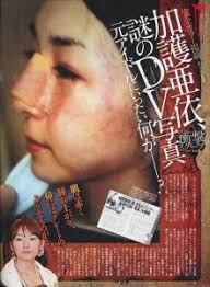 元夫・安藤陽彦とD◯離婚：初婚の苦悩と離別2